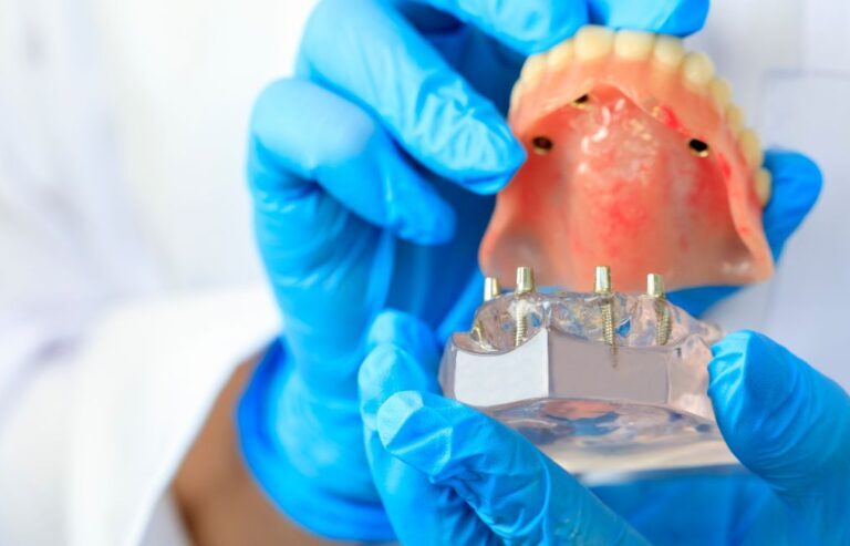 Dental-destination-romania-1024x493 Dental-destination-romania-1024x493