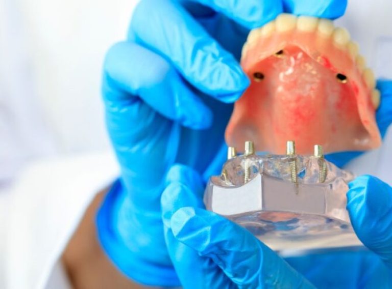 Dental-destination-romania-1024x493 Dental-destination-romania-1024x493