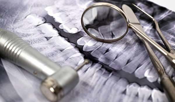 dental-medicine-600x350 dental-medicine-600x350